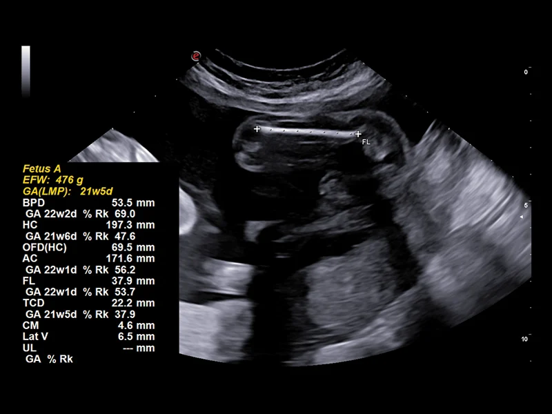 Obstetrics clinical image