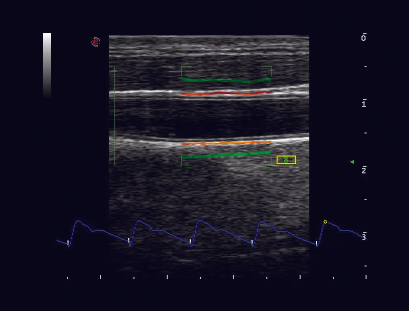 aparat usg do radiologii