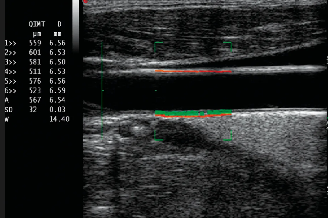 aparat usg do radiologii
