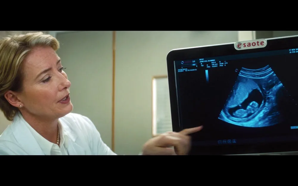 Jak wybrać odpowiedni aparat USG? Dopasowanie ultrasonografu do potrzeb klinicznych