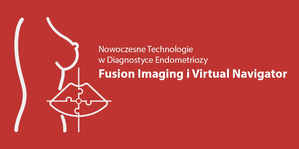 Nowoczesne Technologie w Diagnostyce Endometriozy – Fusion Imaging i Virtual Navigator