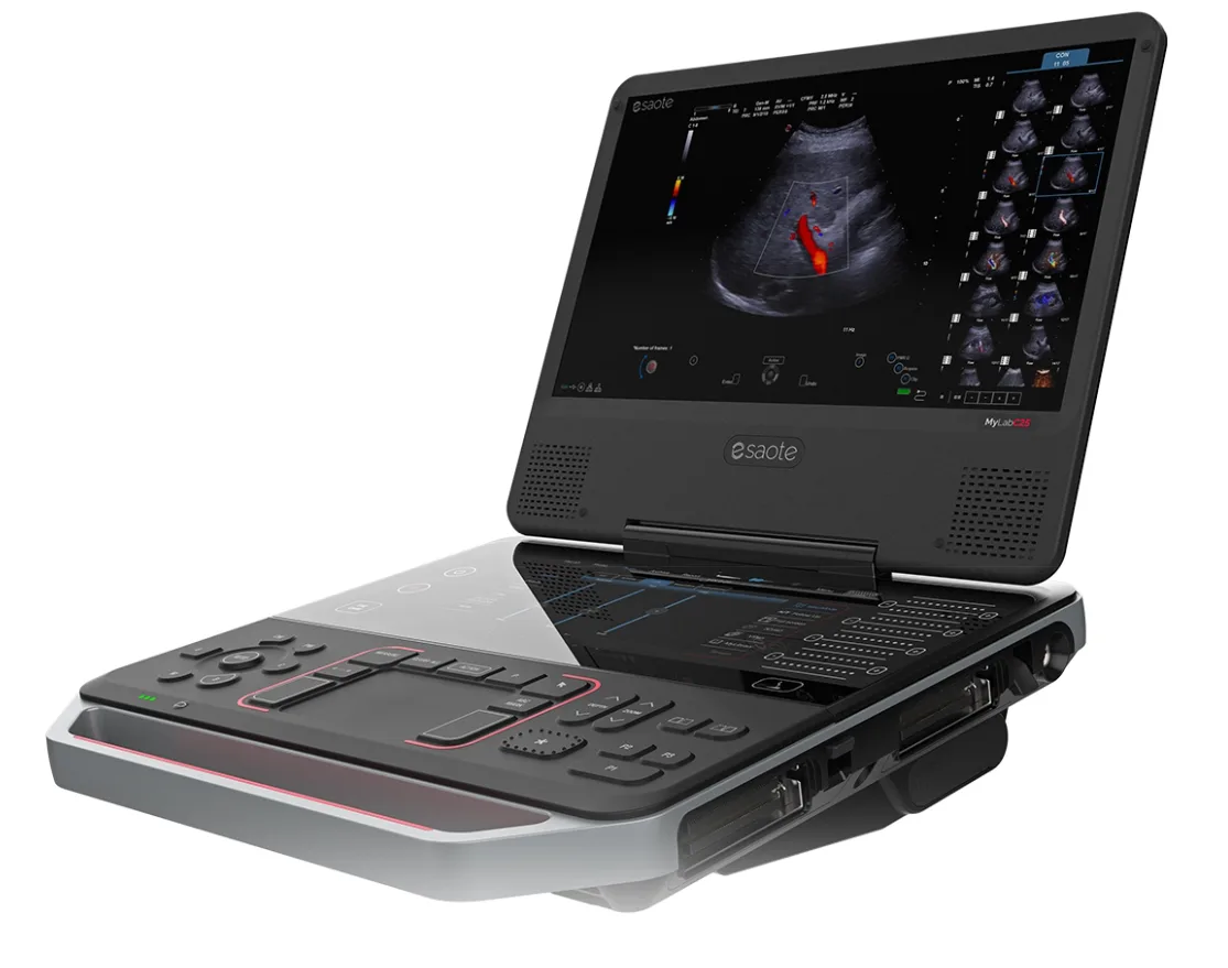 Esaote MyLab C25